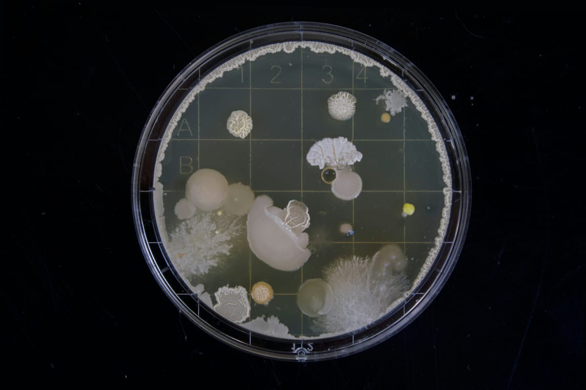 Protozoa are small, and bacteria are small, but viruses are smaller than the both put together.